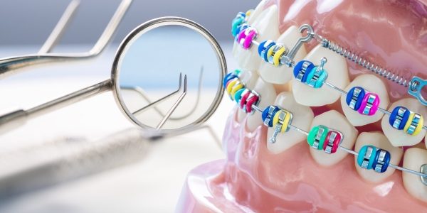 Preguntas frecuentes sobre ortodoncia Preguntas frecuentes sobre ortodoncia