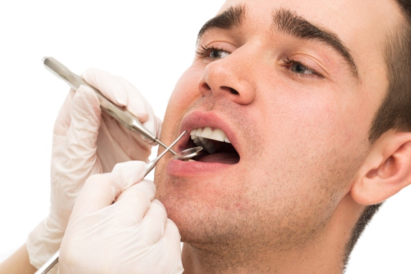 ¿Qué es la hipoplasia dental?